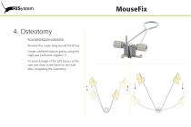 MouseFix-15
