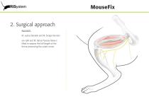 MouseFix-8