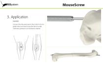 MouseScrew-13
