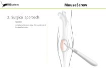 MouseScrew-8