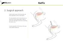 RatFix-7