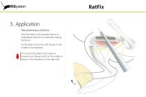 RatFix-9