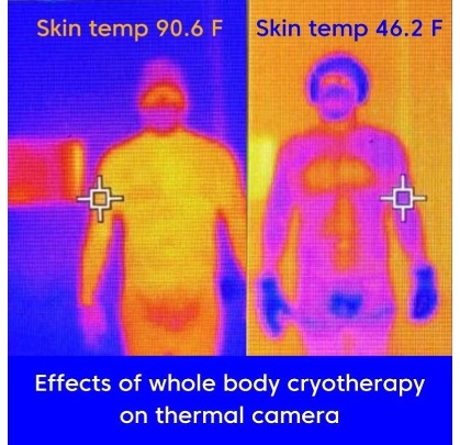 CryoBuilt Photo 2