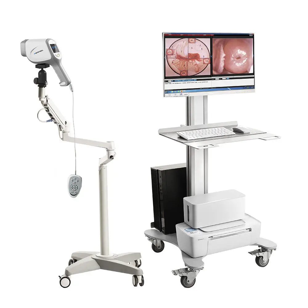 Videocolposcópio - KN-2200A - Kernel Medical Equipment Co., Ltd