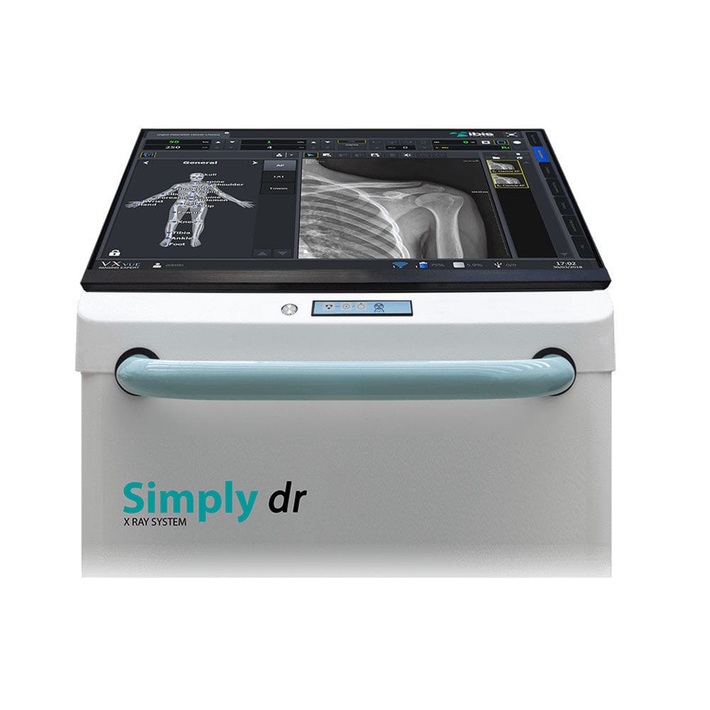 Sistema móvel de radiografia digital - Simply dr - IBIS X Ray Systems