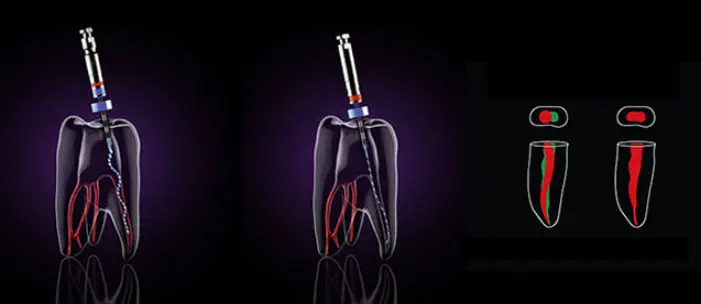 Lima endodôntica rotativa - XP-endo® Shaper - FKG Dentaire - para