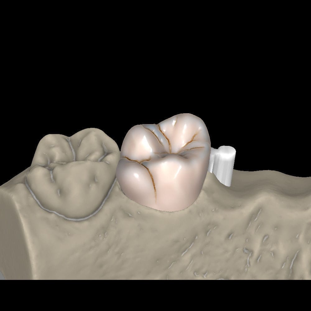 Módulo de software CAD - Attachments - Zirkonzahn - CAM / para fabrico ...