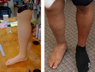 Prótese estética para perna - Boston Orthotics + Prosthetics - para adulto