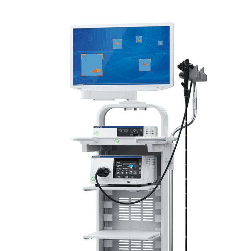 Sistema de endoscopia - EVIS X1™ - Olympus America