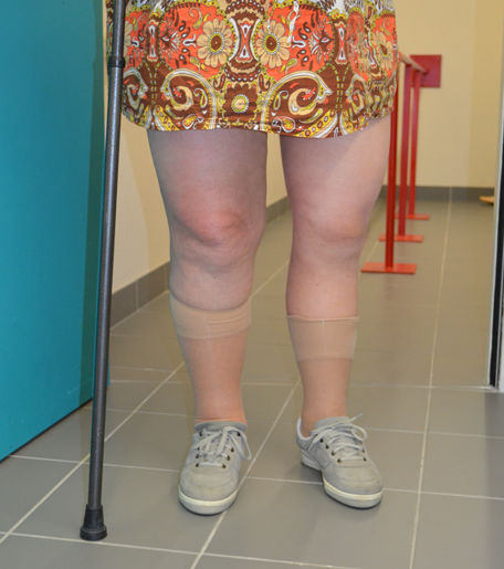 Prótese estética para perna - Protunix - para adulto