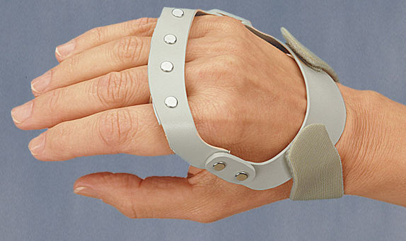 Neuropatia motora leve