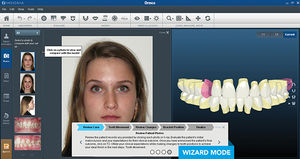 software de design digital de sorriso 1
