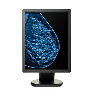 monitor médico