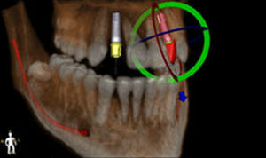 software de cirurgia