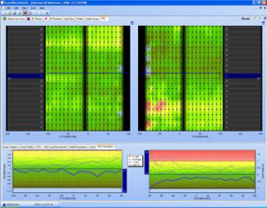software para radioterapia