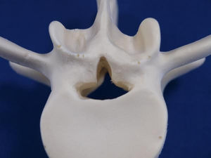 modelo de disco intervertebral