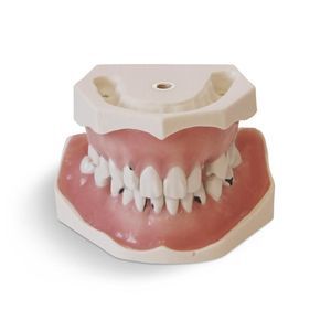 modelo de dente 1
