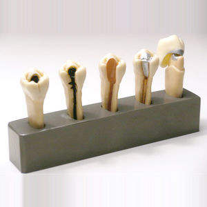 modelo de dente