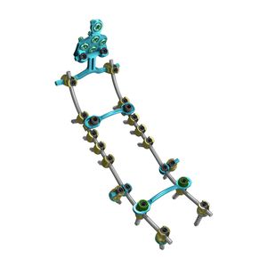 sistema de osteossíntese occípito-cérvico-torácico 1