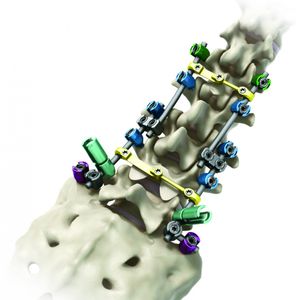 sistema de osteossíntese toracolombossacral 1