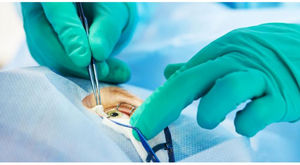 kit médico para cirurgia oftalmológica