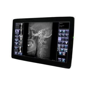 sistema de aquisição de imagens para radiografia
