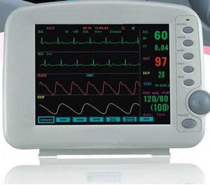 monitor de paciente de ECG