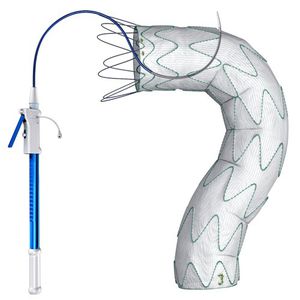 stent-enxerto de aorta torácica