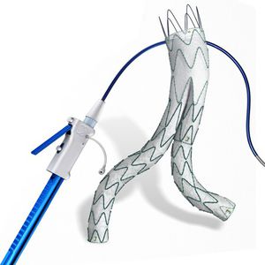 stent-enxerto de aorta abdominal / em nitinol