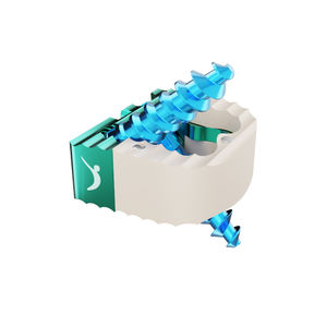 espaçador intervertebral cervical 1