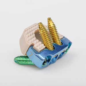espaçador intervertebral cervical