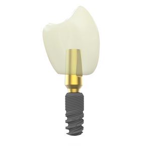 implante dentário cônico 1