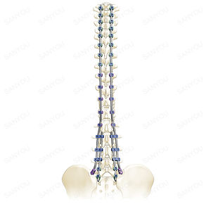 sistema de osteossíntese tóraco-lombo-sacral