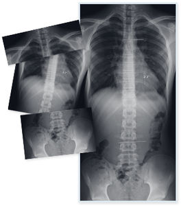 software para radiologia