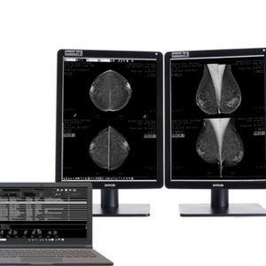 software para mamografia