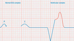 módulo de simulação de ECG