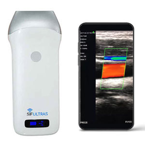 aparelho de ultrassom de bolso 1