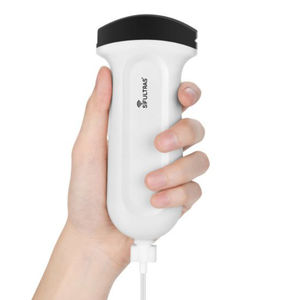 aparelho de ultrassom de bolso 1