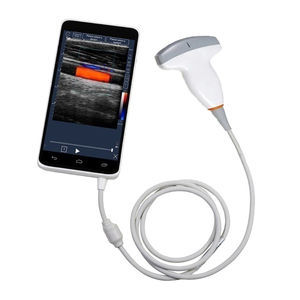 aparelho de ultrassom de bolso 1