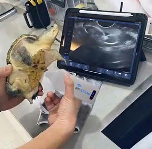 aparelho de ultrassom de bolso