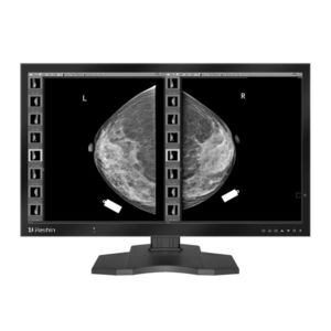 monitor de diagnóstico