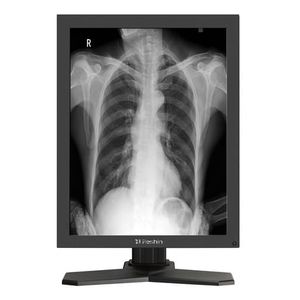monitor 21.3