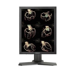 monitor de diagnóstico