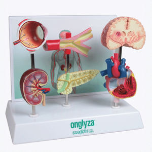 modelo anatômico para diabetes