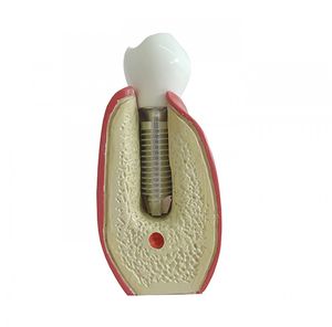 modelo anatômico odontológico