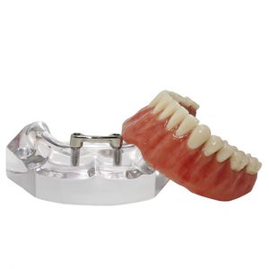 modelo anatômico de dentição