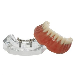 modelo anatômico de dentição