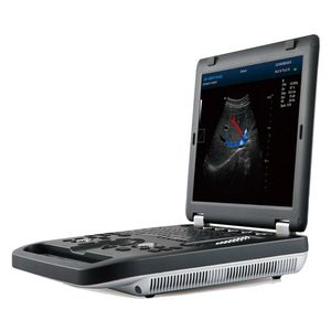 aparelho de ultrassom portátil