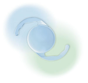 lente intraocular monofocal