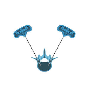 dispositivo para reparação de fraturas vertebrais de agulha